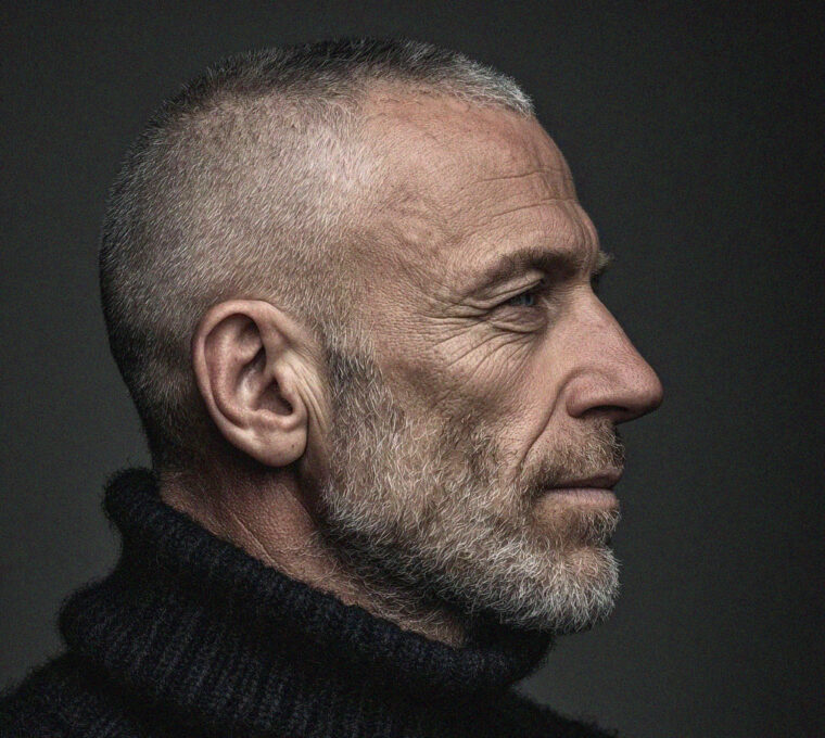 hide receding hairline pochi capelli nascondere la stempiatura taglio capelli uomo